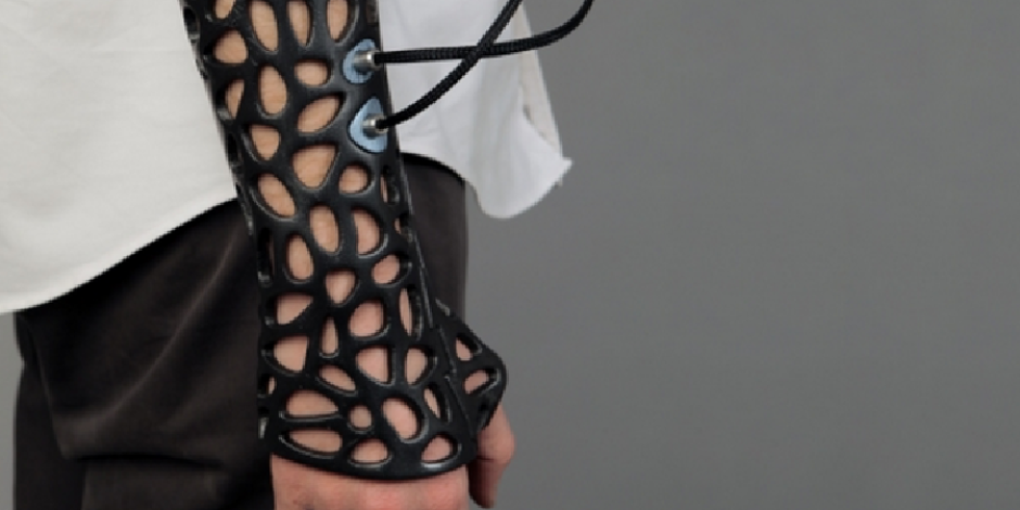 Türk öğrenciden kırıklar için 3D yazıcı ile yapılmış alçı